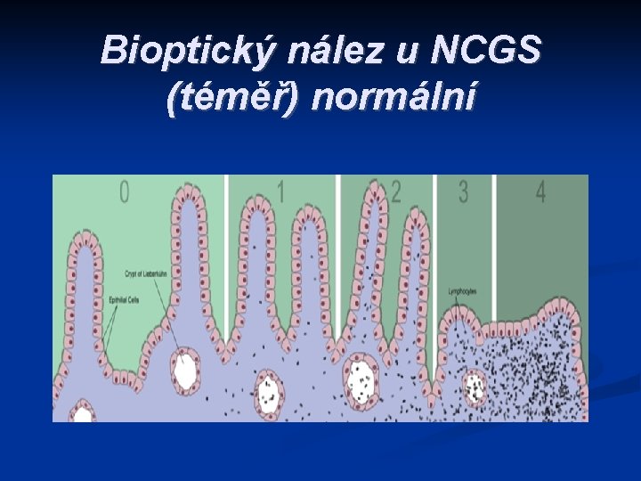 Bioptický nález u NCGS (téměř) normální 