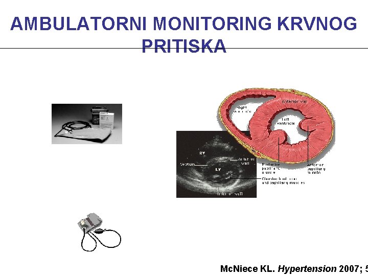 AMBULATORNI MONITORING KRVNOG PRITISKA Mc. Niece KL. Hypertension 2007; 5 