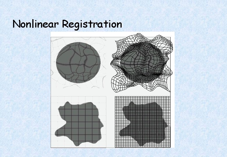 Nonlinear Registration 