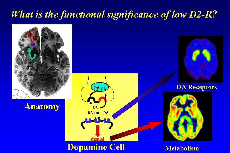 What is the functional significance of low D 2 -R? DA DA Anatomy DA