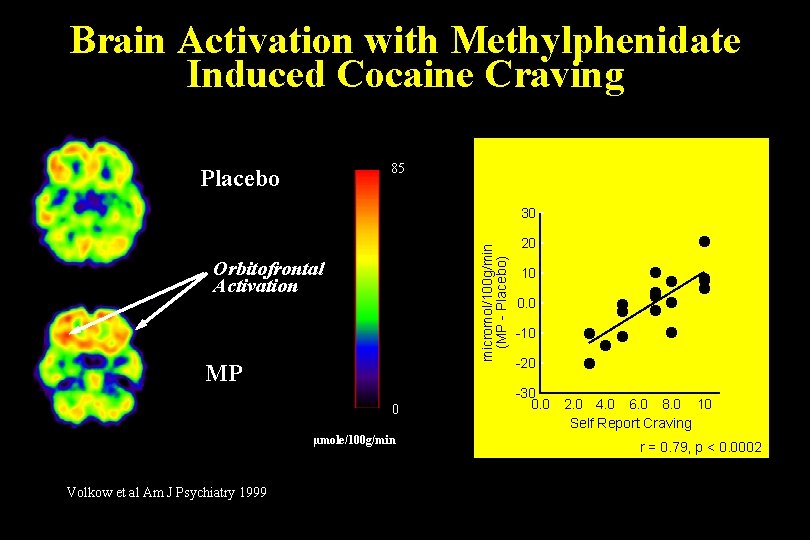 Brain Activation with Methylphenidate Induced Cocaine Craving 85 Placebo micromol/100 g/min (MP - Placebo)
