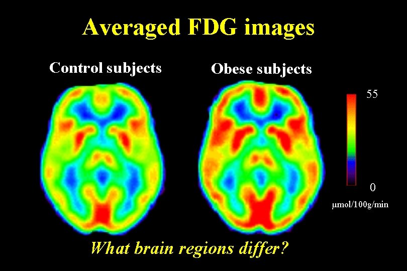 Averaged FDG images Control subjects Obese subjects 55 0 µmol/100 g/min What brain regions