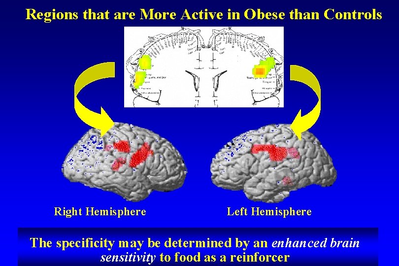 Regions that are More Active in Obese than Controls Right Hemisphere Left Hemisphere The