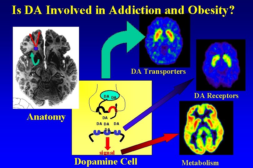 Is DA Involved in Addiction and Obesity? DA Transporters DA DA Anatomy DA Receptors