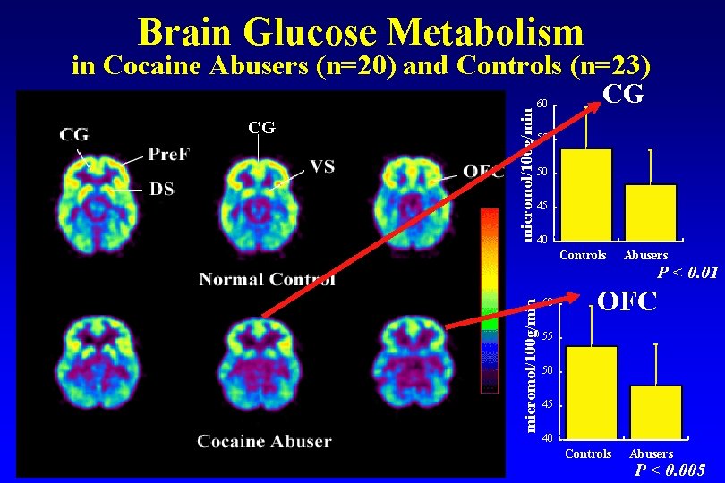 Brain Glucose Metabolism 60 55 50 45 40 Controls Abusers P < 0. 01