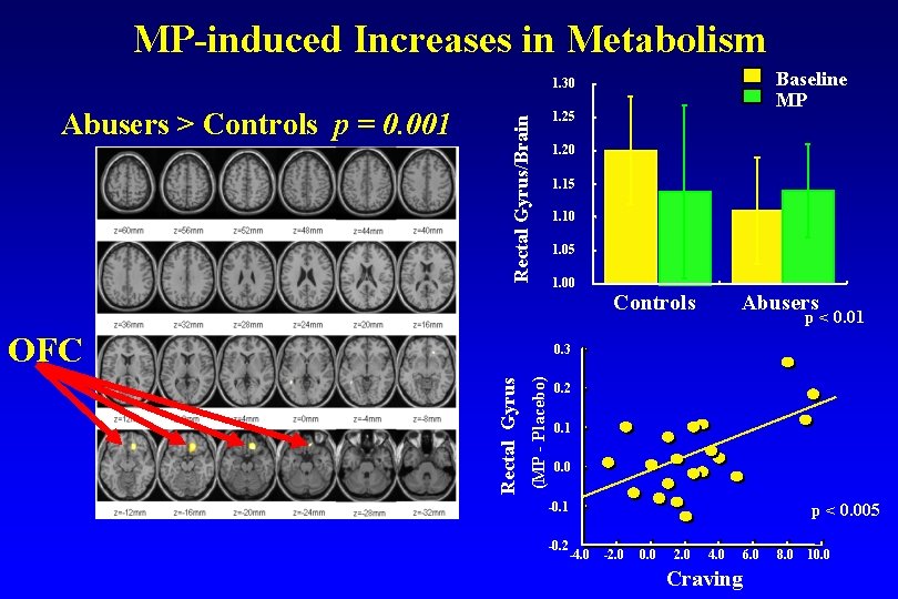 MP-induced Increases in Metabolism Baseline MP 1. 30 1. 25 Rectal Gyrus/Brain Abusers >