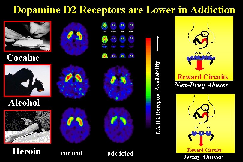 Dopamine D 2 Receptors are Lower in Addiction DA DA DA Cocaine DA D