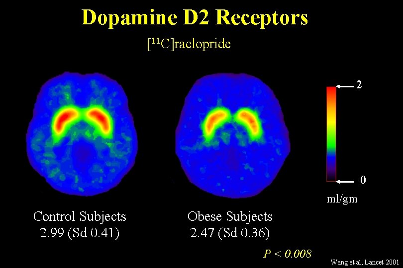 Dopamine D 2 Receptors [11 C]raclopride 2 0 ml/gm Control Subjects 2. 99 (Sd