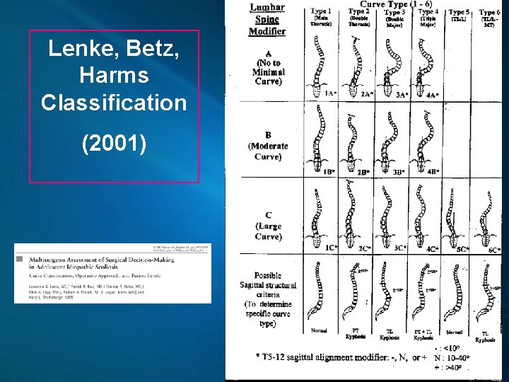 Lenke, Betz, Harms Classification (2001) 