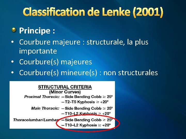 Classification de Lenke (2001) Principe : • Courbure majeure : structurale, la plus importante