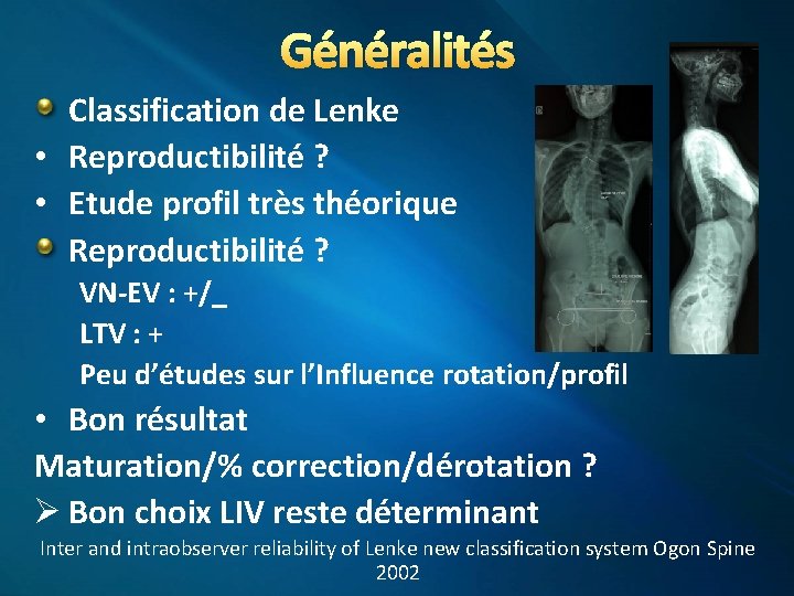 Généralités Classification de Lenke • Reproductibilité ? • Etude profil très théorique Reproductibilité ?