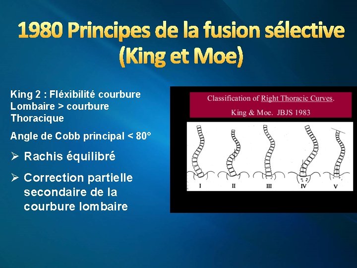 1980 Principes de la fusion sélective (King et Moe) King 2 : Fléxibilité courbure