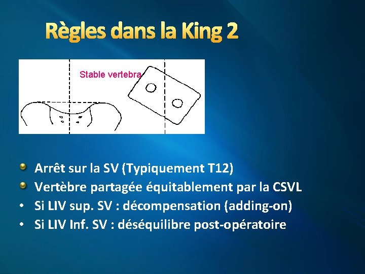 Règles dans la King 2 Stable vertebra Arrêt sur la SV (Typiquement T 12)