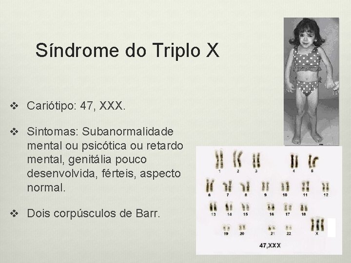 Síndrome do Triplo X v Cariótipo: 47, XXX. v Sintomas: Subanormalidade mental ou psicótica