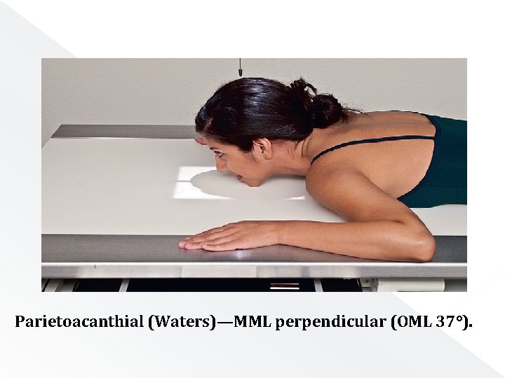 Parietoacanthial (Waters)—MML perpendicular (OML 37°). 