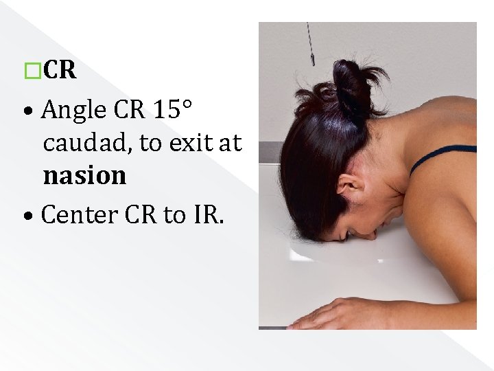 �CR • Angle CR 15° caudad, to exit at nasion • Center CR to