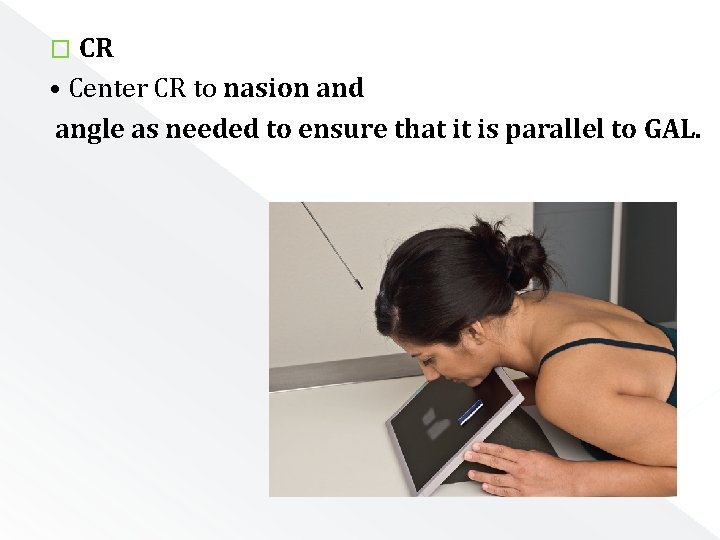 CR • Center CR to nasion and angle as needed to ensure that it