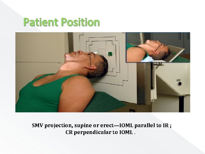Patient Position SMV projection, supine or erect—IOML parallel to IR ; CR perpendicular to