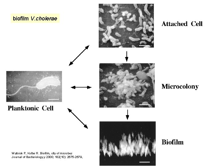 biofilm V. cholerae Watnick P, Kolter R. Biofilm, city of microbes Journal of Bacteriology,