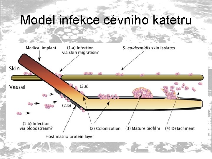 Model infekce cévního katetru 