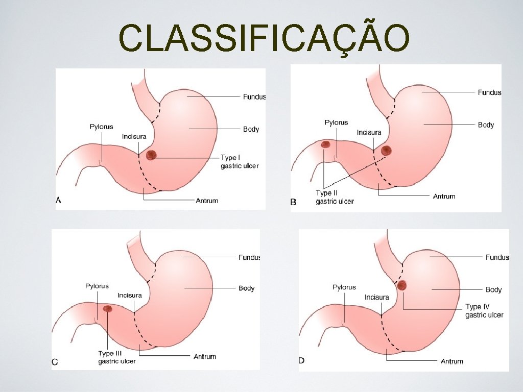 CLASSIFICAÇÃO 