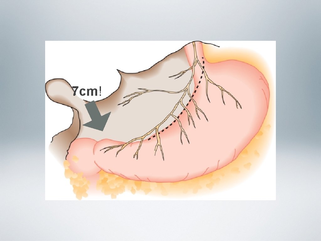 7 cm! 