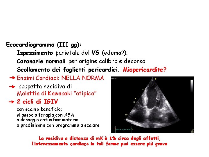 Ecocardiogramma (III gg): Ispessimento parietale del VS (edema? ). Coronarie normali per origine calibro