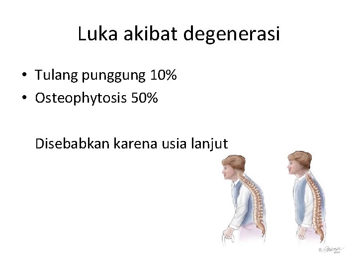 Luka akibat degenerasi • Tulang punggung 10% • Osteophytosis 50% Disebabkan karena usia lanjut