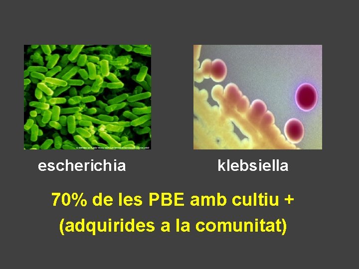 escherichia klebsiella 70% de les PBE amb cultiu + (adquirides a la comunitat) 