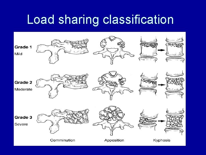 Load sharing classification 