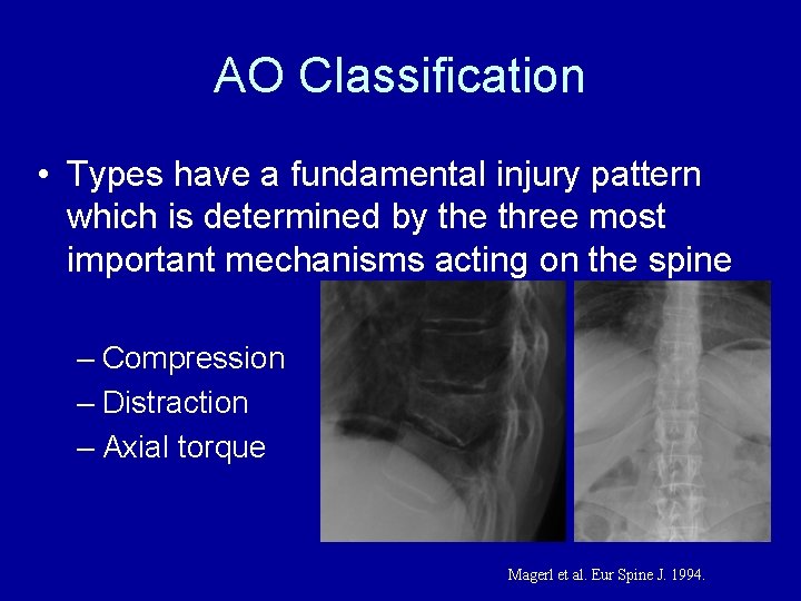 AO Classification • Types have a fundamental injury pattern which is determined by the