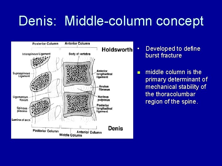 Denis: Middle-column concept • Developed to define burst fracture n middle column is the