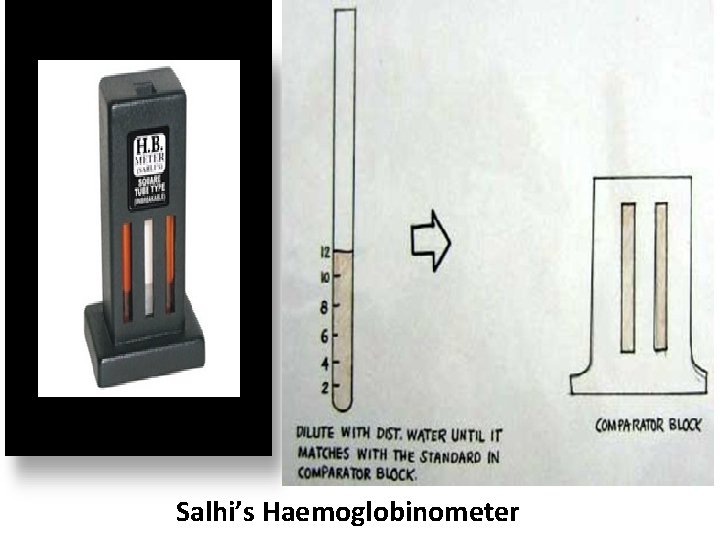 Salhi’s Haemoglobinometer 