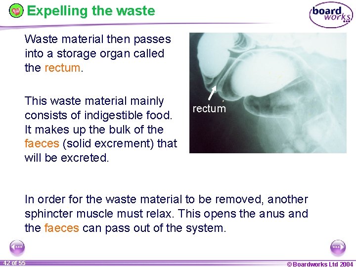 Expelling the waste Waste material then passes into a storage organ called the rectum.