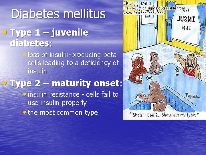 Diabetes mellitus • Type 1 – juvenile diabetes: • loss of insulin-producing beta cells