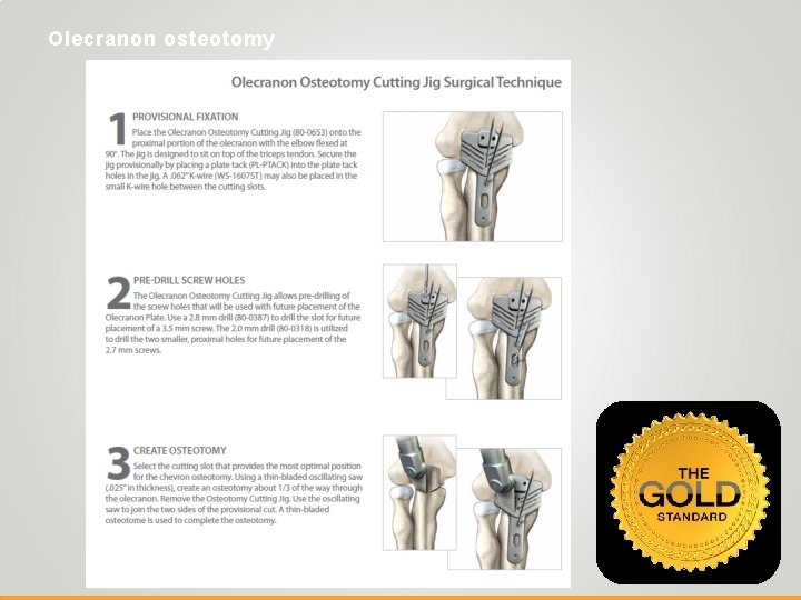 Olecranon osteotomy 