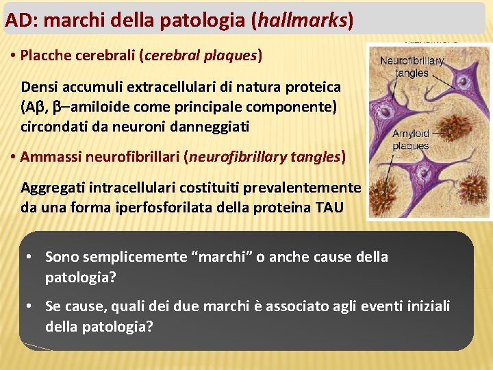 AD: marchi della patologia (hallmarks) • Placche cerebrali (cerebral plaques) Densi accumuli extracellulari di