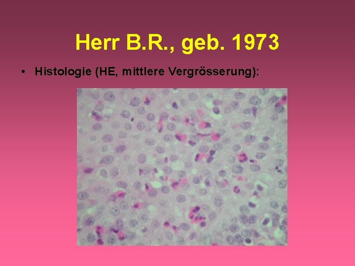 Herr B. R. , geb. 1973 • Histologie (HE, mittlere Vergrösserung): 