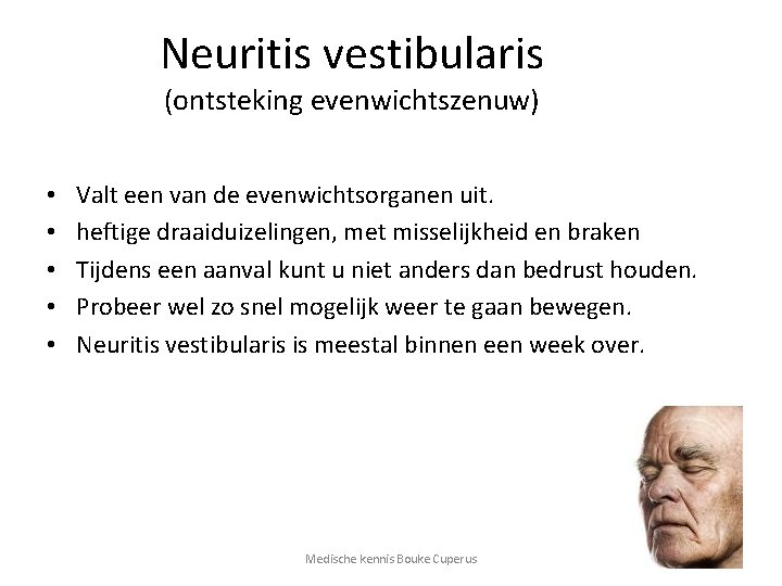 Neuritis vestibularis (ontsteking evenwichtszenuw) • • • Valt een van de evenwichtsorganen uit. heftige