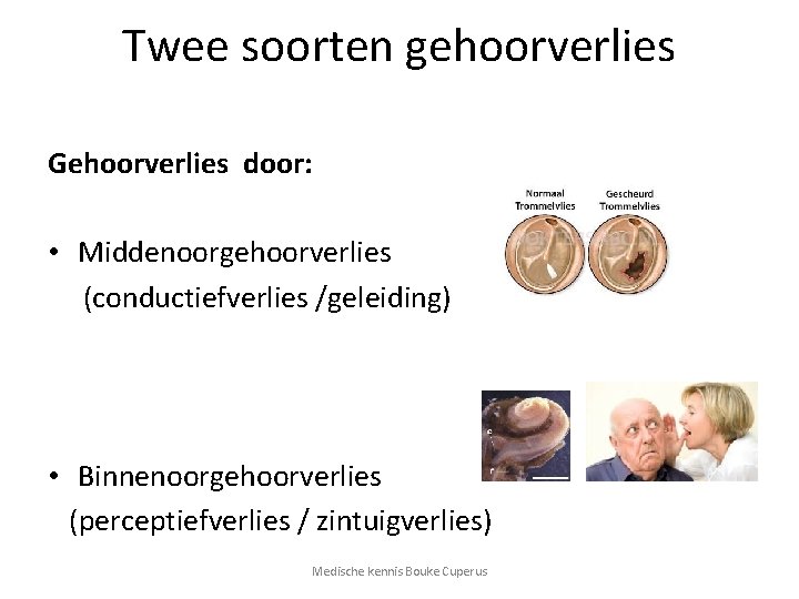 Twee soorten gehoorverlies Gehoorverlies door: • Middenoorgehoorverlies (conductiefverlies /geleiding) • Binnenoorgehoorverlies (perceptiefverlies / zintuigverlies)