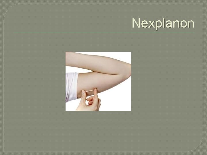 Nexplanon 