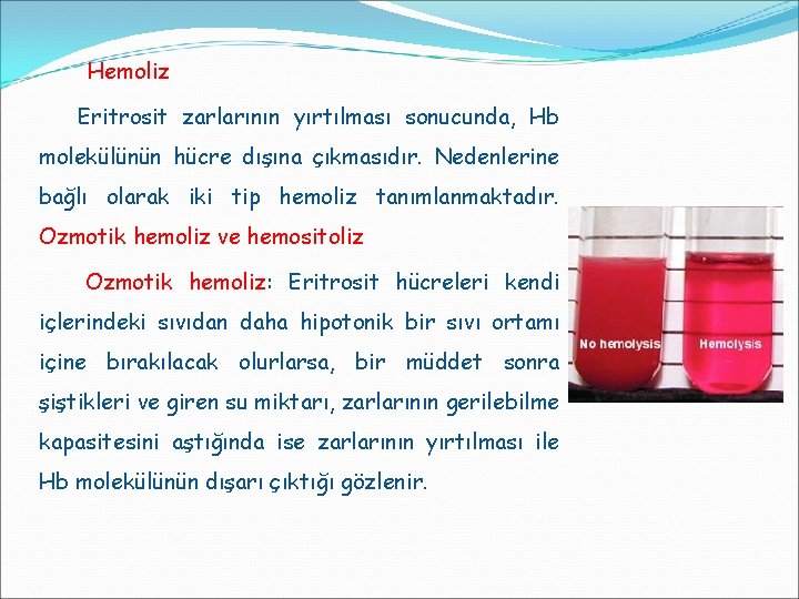 Hemoliz Eritrosit zarlarının yırtılması sonucunda, Hb molekülünün hücre dışına çıkmasıdır. Nedenlerine bağlı olarak iki