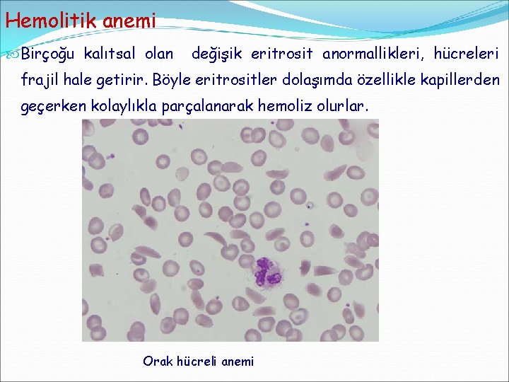 Hemolitik anemi Birçoğu kalıtsal olan değişik eritrosit anormallikleri, hücreleri frajil hale getirir. Böyle eritrositler