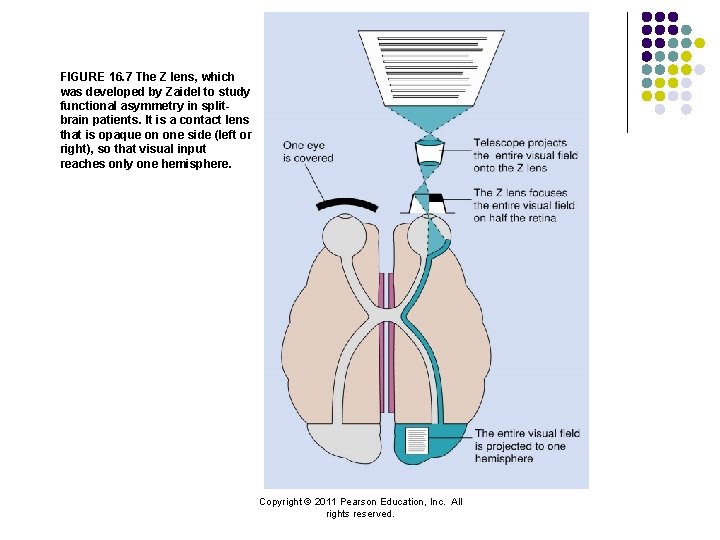 FIGURE 16. 7 The Z lens, which was developed by Zaidel to study functional