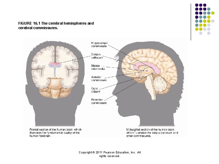 FIGURE 16. 1 The cerebral hemispheres and cerebral commissures. Copyright © 2011 Pearson Education,