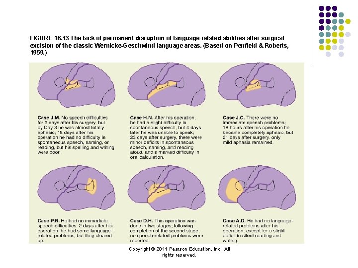 FIGURE 16. 13 The lack of permanent disruption of language-related abilities after surgical excision