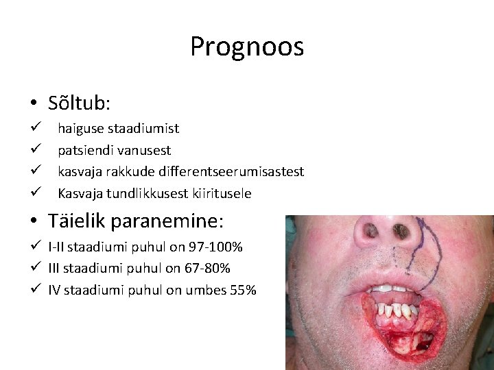 Prognoos • Sõltub: ü ü haiguse staadiumist patsiendi vanusest kasvaja rakkude differentseerumisastest Kasvaja tundlikkusest