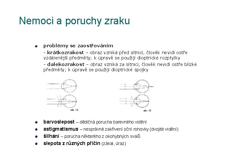 Nemoci a poruchy zraku problémy se zaostřováním - krátkozrakost – obraz vzniká před sítnicí,