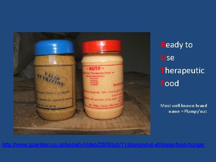 Ready to Use Therapeutic Food Most well-known brand name = Plumpy’nut http: //www. guardian.