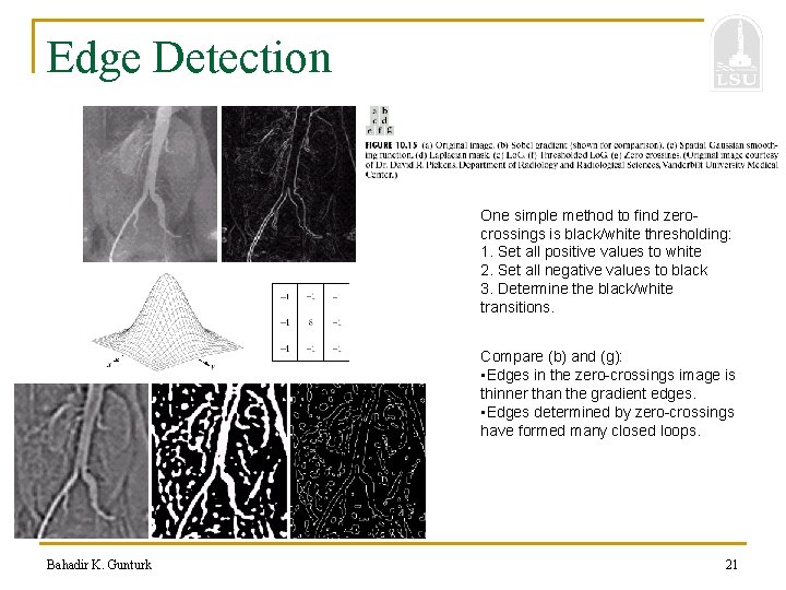 Edge Detection One simple method to find zerocrossings is black/white thresholding: 1. Set all